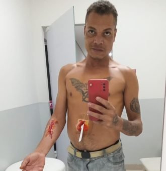 moulage